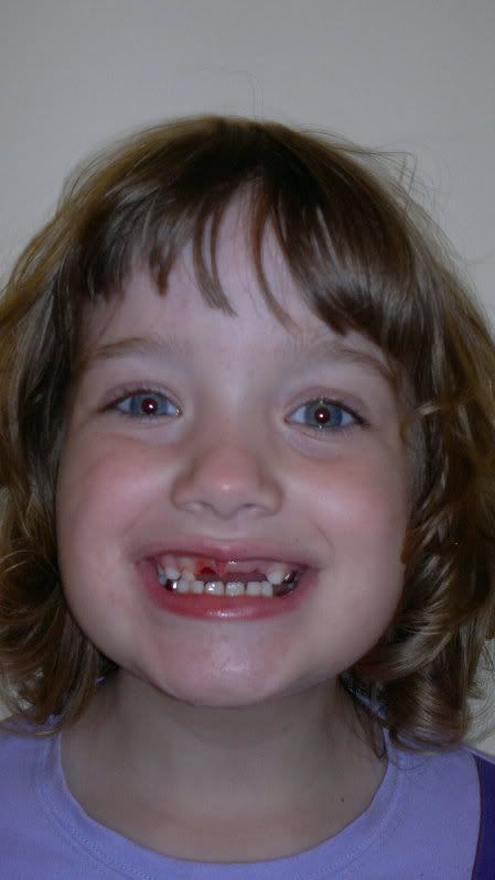 All I want for Christmas is my 2 front teeth