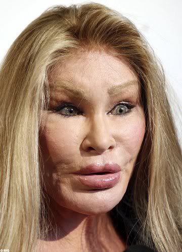 The woman above was in trouble for giving bad plastic surgery to people