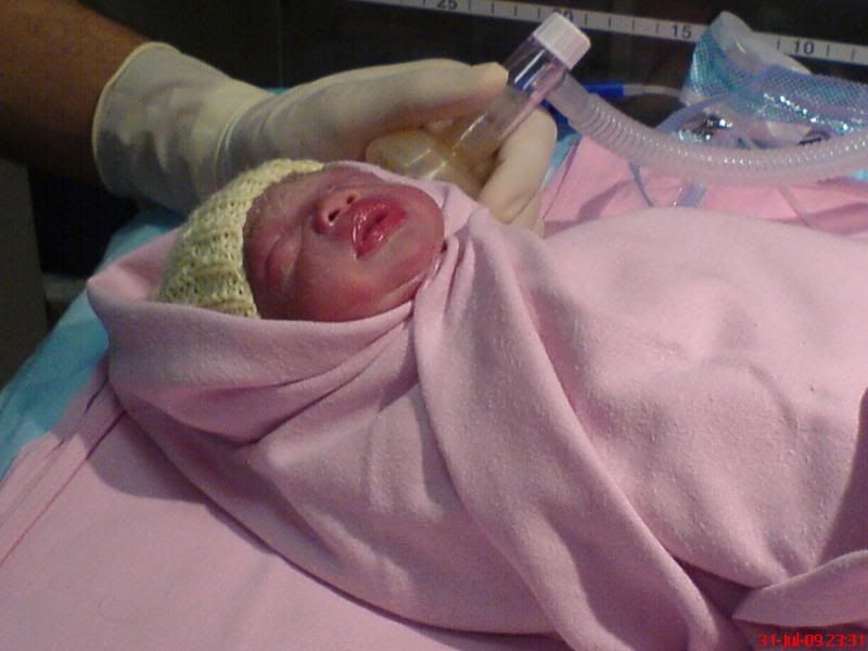 Baby V after birth